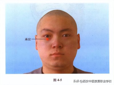 足阳明胃经经穴——承泣
