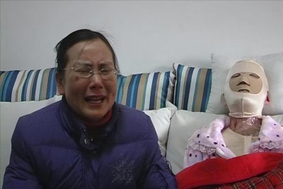 ​因拒绝同学求爱，遭富二代报复毁容的周岩，10年后她过得如何了？